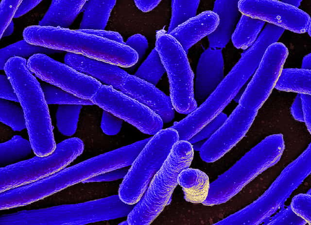 La bactérie <em>Escherichia coli </em>est parfois impliquée dans des infections nosocomiales graves. © NIAID, Flickr, CC by 2.0
