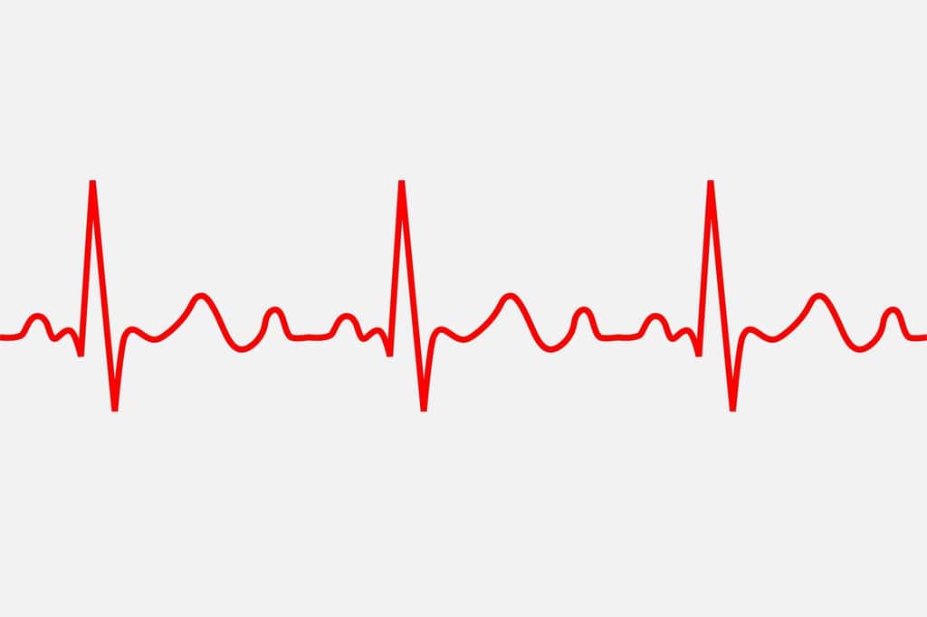 Lorsque le rythme cardiaque se dérègle, il s’agit d’une arythmie cardiaque. © Maxim Grebeshkov, Fotolia