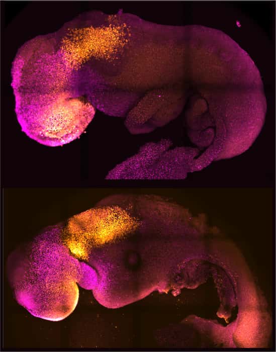 Embryon naturel (en haut) et embryon synthétique (en bas), montrant une formation comparable du cerveau et du cœur. © Amadei et Handford, 2022