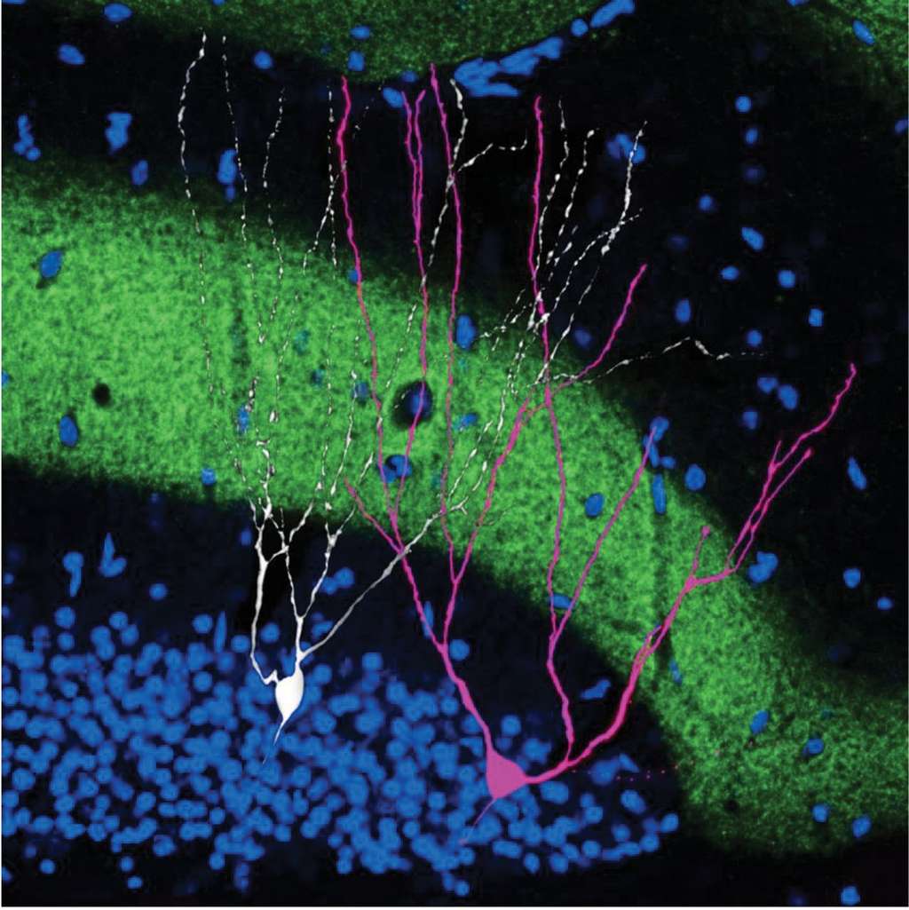 Sur cette image, les neurones actifs durant une expérience de peur apparaissent en rose. Les neurones inactifs en blanc et en vert, il s’agit de la voie perforante, une structure de l’hippocampe. © Adapté de T. J. Ryan et al., <em>Science</em>