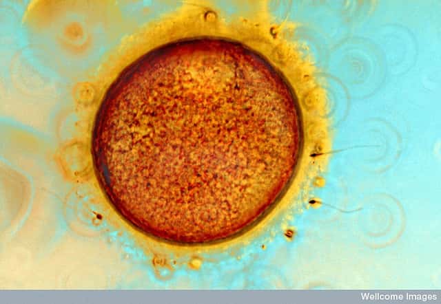 Si deux spermatozoïdes fécondent l’ovocyte, l’embryon n'est pas viable. Les chercheurs chinois se sont servis de cette particularité pour effectuer leur recherche. © Spike Walker, Wellcome Images, Flickr, CC by-nc-nd 2.0