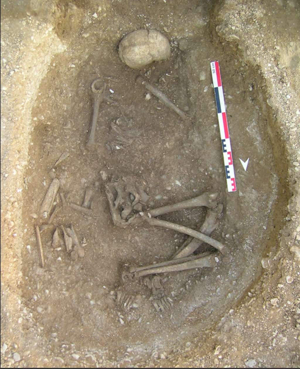 Photographie de la femme GLN270A (à droite, pas de résultats génétiques) avec laquelle les os longs de l’ancêtre principal GLN270B du grand arbre généalogique (à gauche) ont été ré-enterrés. © Stéphane Rottier, The Conversation