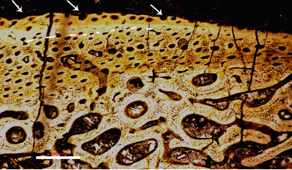 Microphotographie d’une section réalisée dans un os fossilisé de <em>Psittacosaurus </em>trouvé dans le groupe géologique Jehol (Chine). Les trous d’abrasion visibles à la surface, mais aussi les craquelures qui en partent en disent long sur les conditions de la mort du dinosaure. La barre d’échelle vaut 500 µm. © Baoyu Jiang