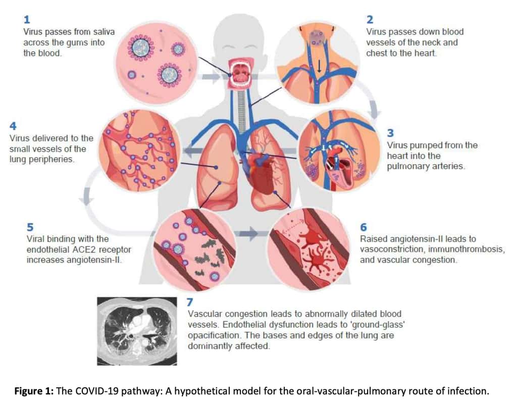 Le voyage du coronavirus de la bouche jusqu'aux poumons selon l'hypothèse des scientifiques. © Graham Lloyd-Jones et <em>al. Journal of Oral Medicine and Dental Research</em> 