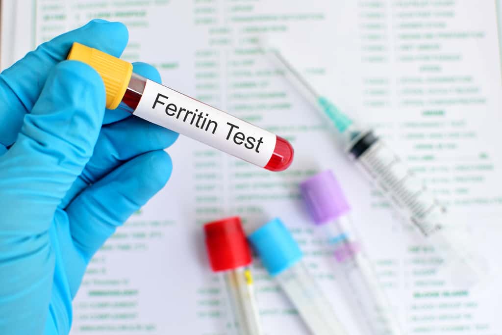 Un taux élevé de ferritine dans le sang associé à une grande fatigue doit faire penser à une hémochromatose. © jarun011, Fotolia