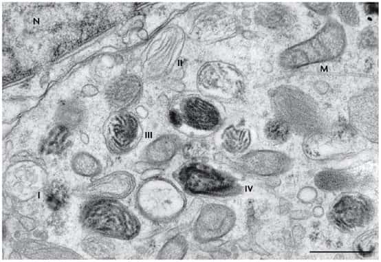Un mélanocyte humain dans lequel des mélanosomes sont observés à différents stades de leur maturation (numérotés de I à IV). On remarque le noyau de la cellule (N) et une mitochondrie (M). La barre d'échelle représente 0,5 micron. © Graça Raposo &amp; Michael S. Marks/Nature Rewiews/Molecular Cell Biology