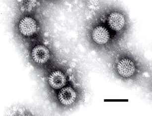 C'est leur forme circulaire qui leur vaut leur nom de rotavirus. Ici observés en microscopie électronique à transmission, la barre noire représente 100 nm. © FP Williams, Wikipédia, DP