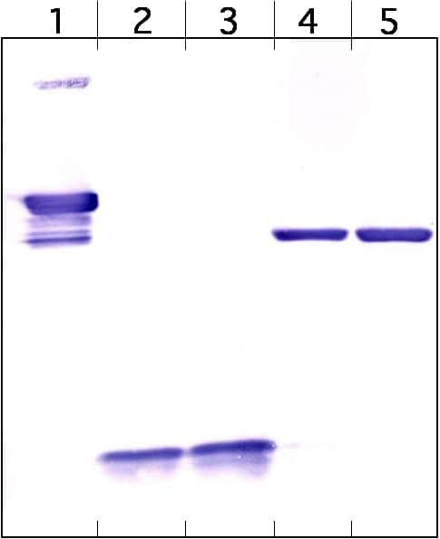 Image d’une membrane de western blot. Les bandes foncées correspondent aux protéines qui ont interagi avec les anticorps marqués utilisés. © JWSchmidt, Wikimedia Commons, cc by sa 3.0
