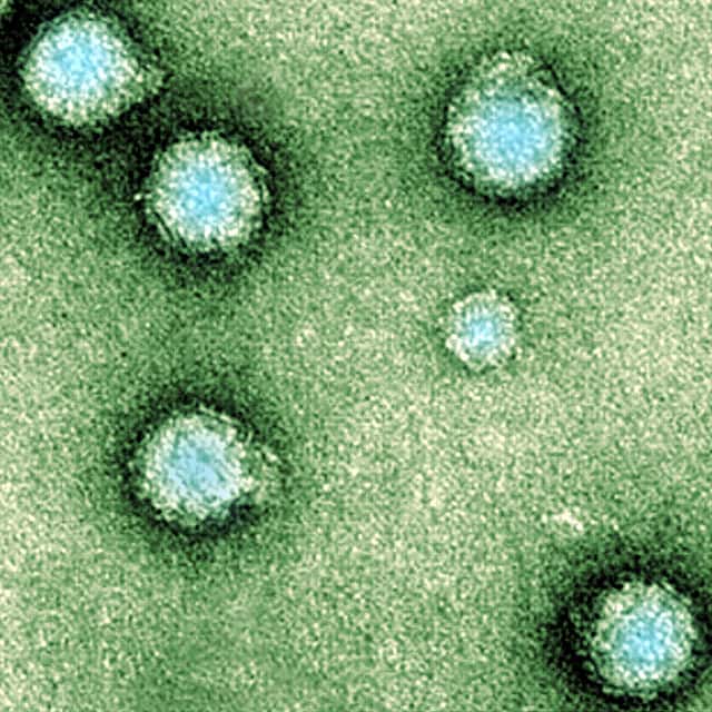 Le virus du Chikungunya possède une forme sphérique. © AJC1, Flickr, CC by-nc 2.0