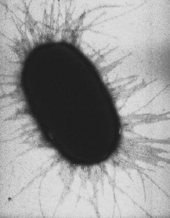 Image de microscopie électronique d’une bactérie Escherichia coli. Les appendices entourant la bactérie sont des fimbriae. © Manu Forero, Wikimedia Commons, cc by sa 3.0