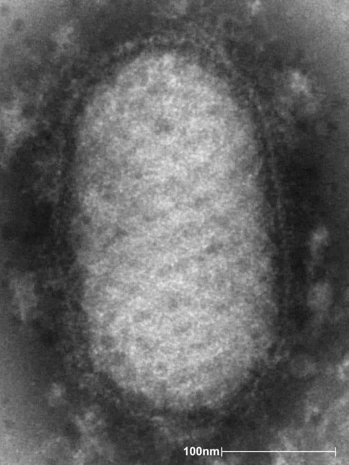 Ce virus Orf visionné au microscope électronique à transmission comprend 134 kpb dans son génome. Il infecte le mouton mais peut se transmettre à l'Homme suite à une morsure. Il est bénin et ne laisse apparaître qu'une inflammation rouge autour de la zone mordue. © Cynthia Goldsmith, CDC, DP