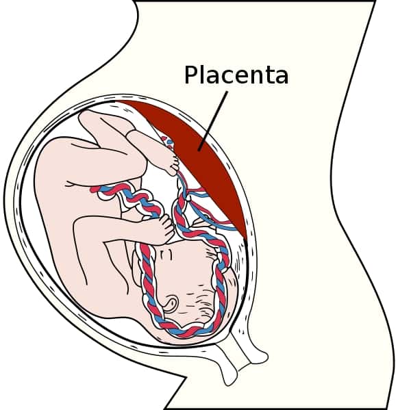 Après une césarienne ou lorsqu'une mère a enfanté plusieurs fois, des lésions peuvent apparaître au niveau de l'utérus. À ces endroits, l'endomètre ne croît pas. Si le placenta s'y fixe dans les premières phases du développement embryonnaire, il est au contact du myomètre. On parle de placenta accreta. Cette anomalie, rare, est malgré tout de plus en plus fréquente, avec l'augmentation du nombre d'accouchements par césarienne. © Henry Gray, Gray's Anatomy, Wikipédia, DP
