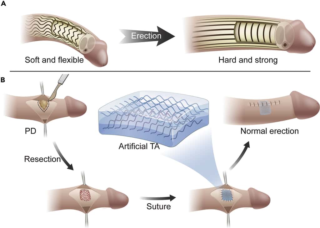 A. Au repos, la <em>Tunica albuginea</em> est flexible mais durant l'érection elle se rigidifie. B. La suture de la <em>Tunica albuginea</em> artificielle permet de retrouver une érection normale chez des cochons. © Chai et al., <em>Bionic artificial penile Tunica albuginea, Matter</em> (2022)
