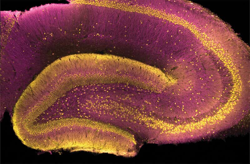 Le gyrus dentelé est la structure jaune en forme de C au milieu de cette coupe transversale de l'hippocampe d'un rat. © Yuni Kay