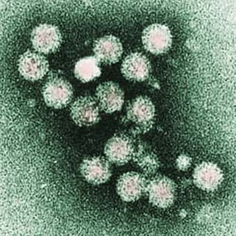 Le virus de l'hépatite C peut aussi infecter le foie et favoriser l'apparition du cancer du foie. © AJ Cann, Flickr, CC by sa 2.0