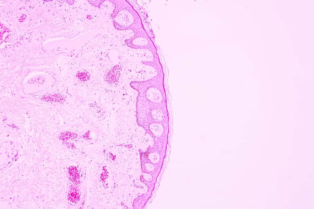 Observation microscopique d’une coupe histologique de tissu mammaire cancéreux. © Arcyto, Adobe Stock 