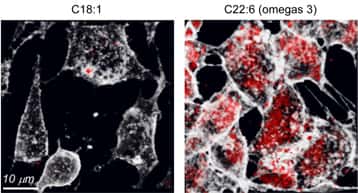 Endocytose de transferrine (transport du fer) dans des cellules contenant des lipides polyinsaturés dans leurs membranes (à droite) par rapport à celle dans des cellules qui en sont dépourvues (à gauche). En 5 minutes, le nombre de vésicules d'endocytose formées (transferrine internalisée en rouge) est augmenté près de 10 fois, reflétant une endocytose facilitée. © Hélène Barelli