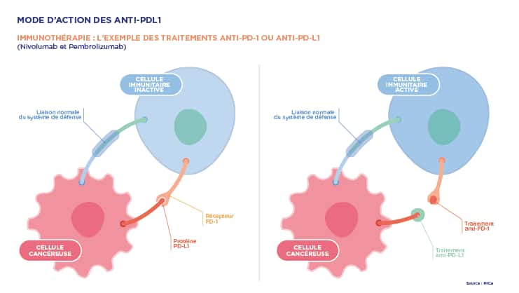 Schéma qui reprend le fonctionnement des anticorps anti-Pd-1 et anti-PD-L1 dans le cadre de l'immunité anticancéreuse. © Leem