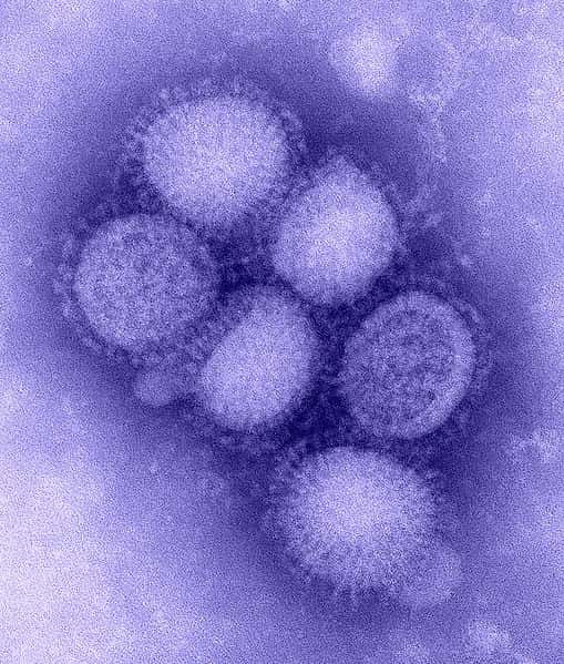 Le virus de la grippe, ou virus influenza, est une structure composée d'ARN et de protéines virales, enveloppées dans une membrane. © DR