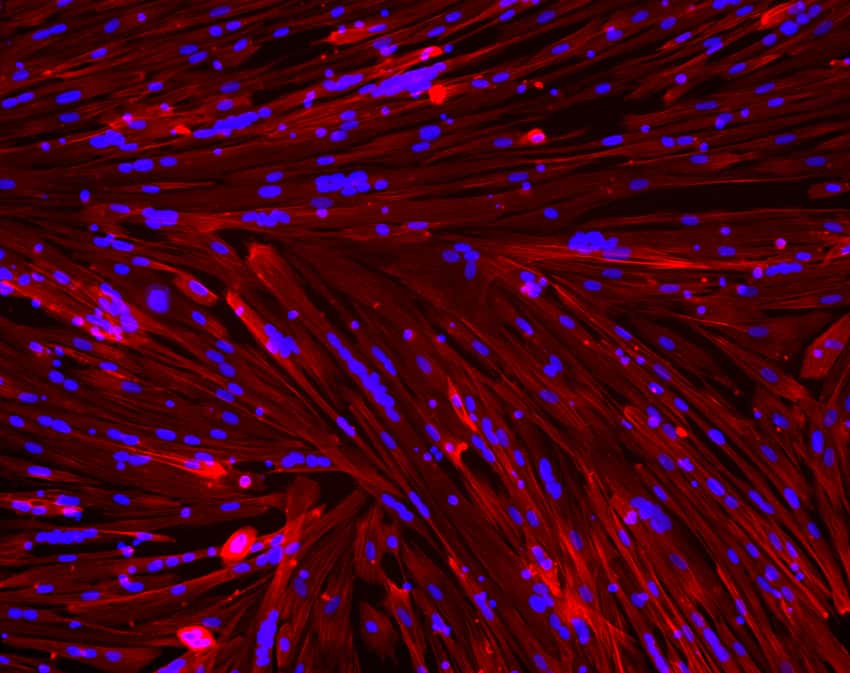 Dans cette culture de myotubes d’un jeune homme sain, l’actine a été colorée grâce à la phalloïdine marquée fluorescente. © Inserm/UMRS 974 