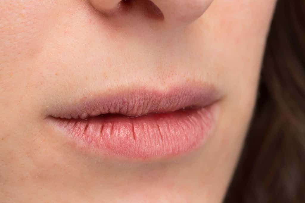 Les lèvres gercées peuvent être douloureuses. © Alessandro Grandini, Adobe Stock