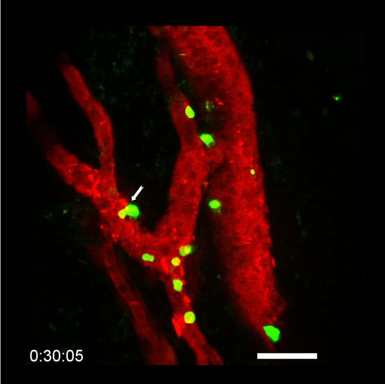 Visualisation en microscopie de lymphocytes (en vert) en train de se faufiler à travers un vaisseau HEV de tumeur (en rouge) au cours du traitement par immunothérapie anti-PD-1 plus anti-CTLA-4. La flèche blanche indique un lymphocyte qui quitte la circulation sanguine et entre dans la tumeur (en noir). © Elisabeth Bellard et Jean-Philippe Girard - IPBS (CNRS/UT3 Paul Sabatier) 