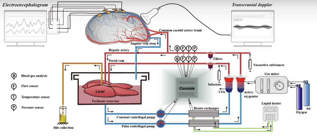 La perfusion normothermique branchée avec un foie réduit les dommages cellulaires et les lésions hypoxiques dans le cerveau des porcs. © Guo et al. 2024