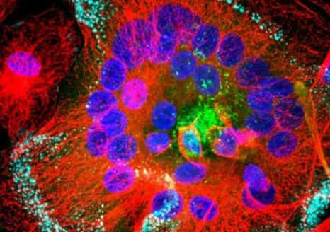 Macrophages infectés par le VIH : les protéines virales sont en vert, les microtubules en rouge et les noyaux en bleu. Taille des noyaux : 5µm. © Inserm, Institut Curie, R. Gaudin, P. Bernaroch