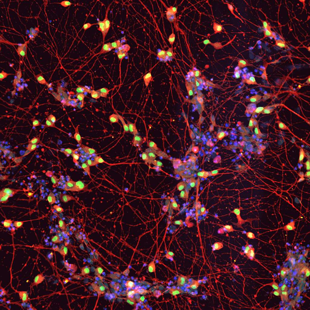 Photo de neuromoteurs dérivés de cellules souches pluripotentes induites, provenant d'un patient atteint de SLA. © Morimoto et <em>al-Cell Stem Cell</em>