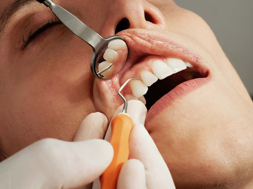 Caries, maladie des gencives, cancers de la bouche : 45 % de la population sur terre n'a pas accès aux soins bucco-dentaires. © Caroline LM, Unsplash