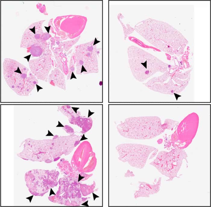 Les flèches noires montrent des métastases dans les poumons des souris malades. À gauche, les souris non traitées, à droite les souris traitées avec C26. © 2021 Khalil et al., <em>Journal of Experimental Medicine</em>