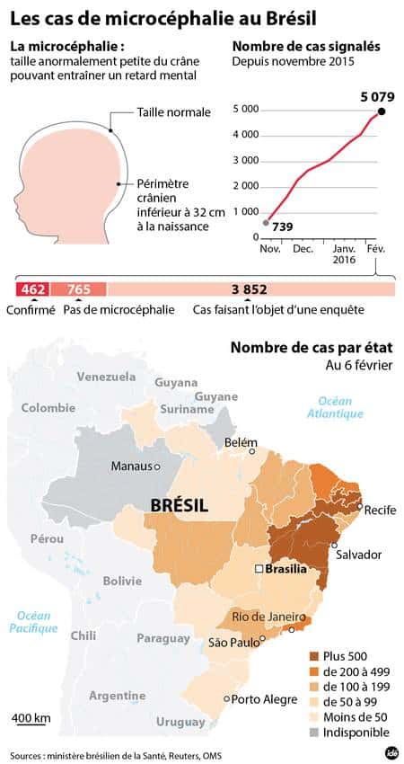 Des milliers de cas de microcéphalies ont été signalés au Brésil depuis novembre 2015. © idé