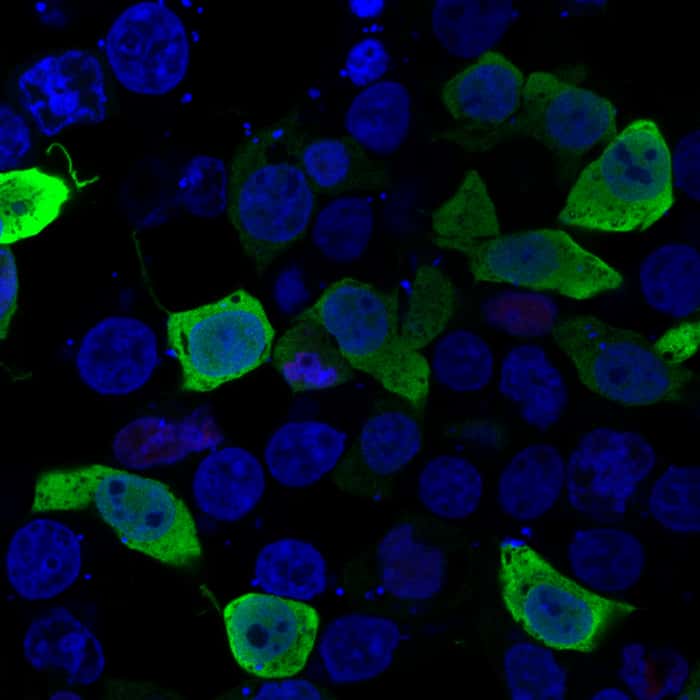 Dans cette image de cellules obtenue par microscopie, une forme mutée d'une protéine appelée ERG, présente chez certains patients atteints de lymphœdème, est représentée en vert, tandis que les noyaux cellulaires sont représentés en bleu. Normalement, la protéine ERG n'existe qu'à l'intérieur des noyaux des cellules. Cependant, la forme mutante observée chez les patients est distribuée en dehors du noyau, dans le cytoplasme des cellules. © Daniela Pirri and Graeme Birdsey, <em>Nature Medicine</em>