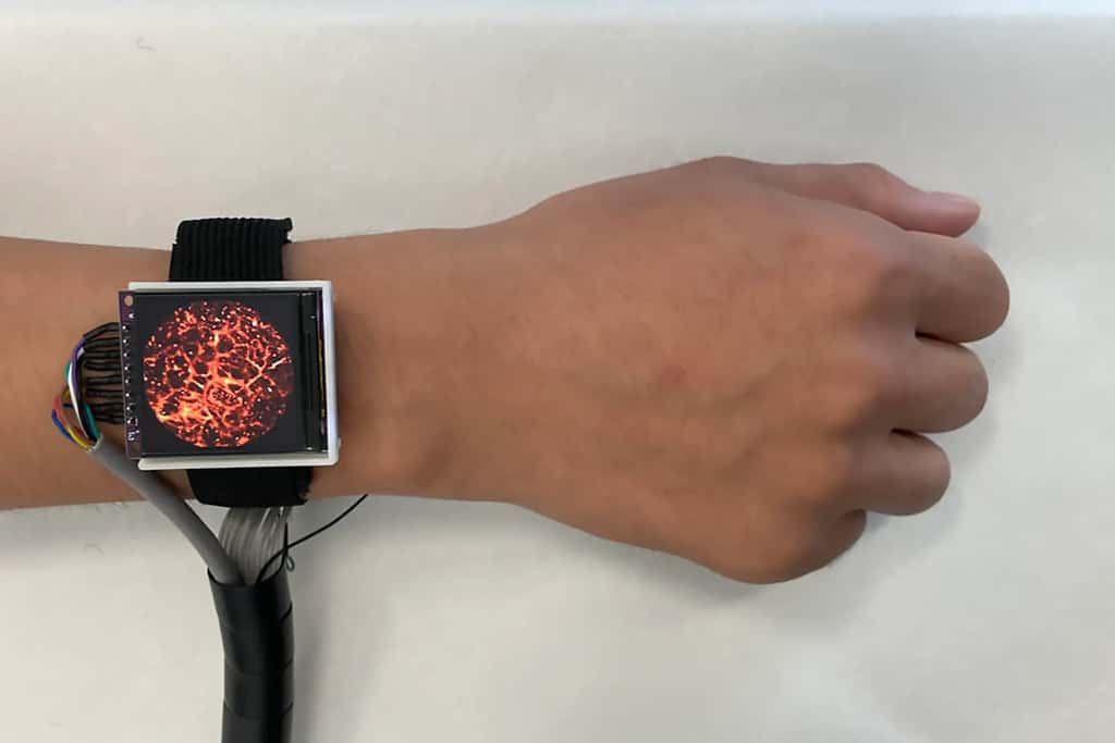Cette montre photoacoustique développée par des chercheurs en Chine permet de voir l’état des microvaisseaux sanguins. © SUSTech