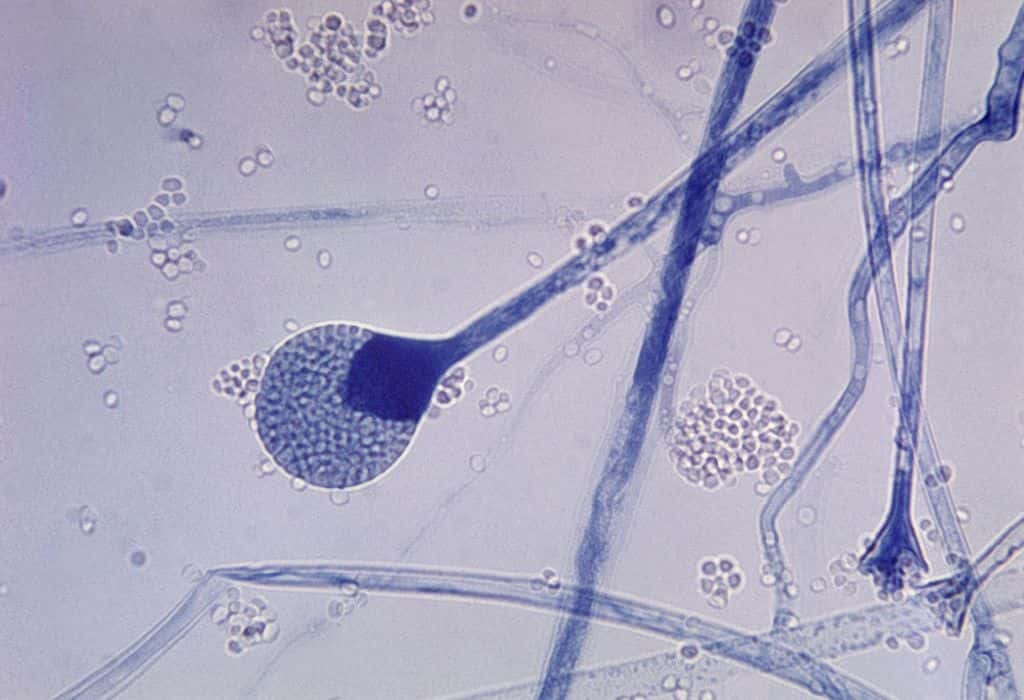 Photo en microscopie optique du sporange d'un champignon de l'ordre des <em>Mucorales</em>. © Domaine public