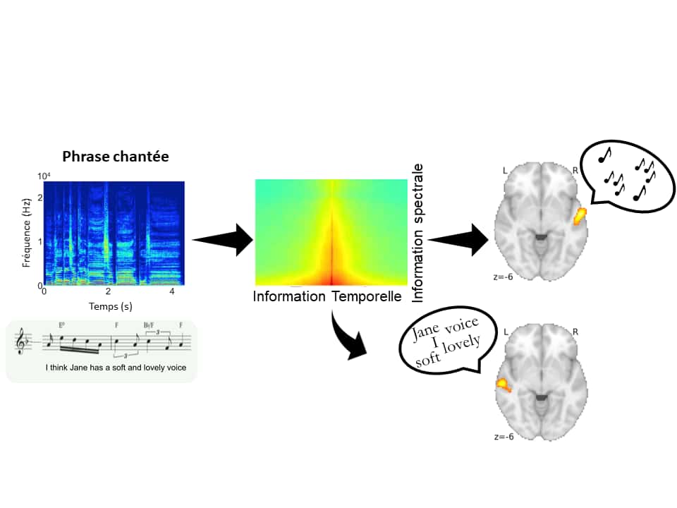 Extrait original de chant <em>a capella</em> (en bas à gauche) et son spectrogramme (au-dessus, en bleu) décomposé en fonction de la quantité d’informations spectrales et temporelles (au centre). Les cortex auditifs droit et gauche du cerveau (côté droit de la figure) décodent respectivement la mélodie et la parole. © Inserm