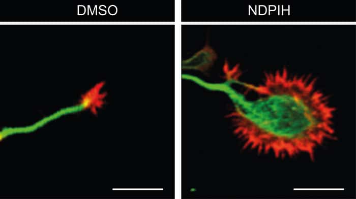 Comparaison entre le neurone témoin (à gauche) et le cône de croissance du neurone de l’hippocampe traité au NDPIH (à droite), un composé actif du champignon « Crinière de lion ». © Université du Queensland