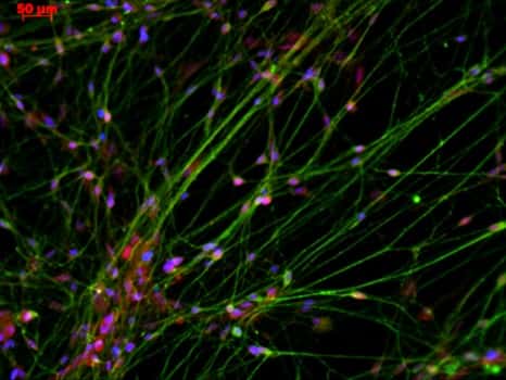 Les motoneurones (ici marqués en rouge) innervent les fibres musculaires de l’organisme. © Inserm/Martinat, Cécile