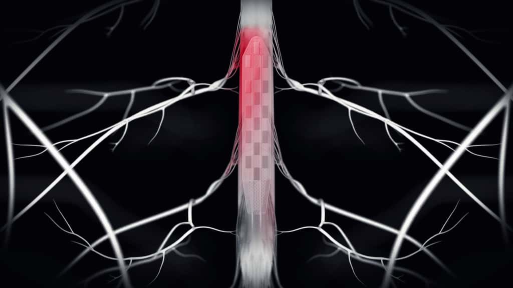 La nouvelle neuroprothèse vise la zone de la moelle épinière responsable de l’activation des muscles des jambes pendant la marche. © CHUV