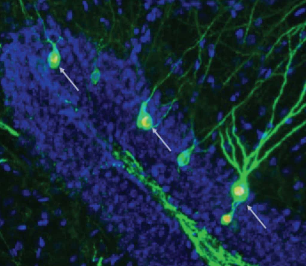 En stimulant la neurogenèse, on augmente le nombre de neurones nouvellement formés (flèches) impliqués dans le stockage et la récupération des souvenirs de l’hippocampe de souris atteintes de la maladie d’Alzheimer. © 2022 Mishra et al.