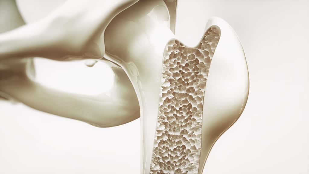 L'ostéoporose correspond à une fragilisation des os. © crevis, Fotolia