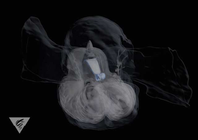 Cette animation 3D montre la structure interne de la bulle de mucus fabriquée par un larvacé, qui ondule au milieu. © Digital Life Project, université du Massachussetts, MBARI 2020