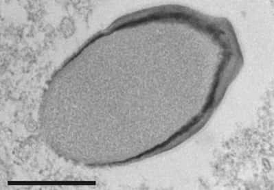 Virus <em>P. quercus</em> observé au microscope électronique. La barre représente 500 nm. © Legendre <em>et al., Nature Communications 2018</em>