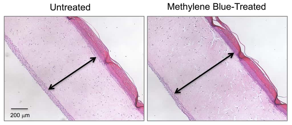 Coupes de peau (modèle avec des cellules vivantes) : à gauche sans traitement, à droite avec le bleu de méthylène. L’épaisseur est plus importante avec le traitement. © Zheng-Mei Xiong, <em>University of Maryland </em>