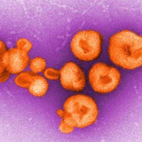 Image colorisée d'un <em>Arenavirus</em>. © CDC
