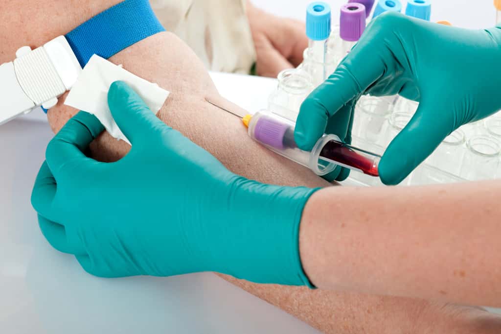 Pour mesurer l'HbA1C, une simple prise de sang suffit. © Alexander Raths, Shutterstock