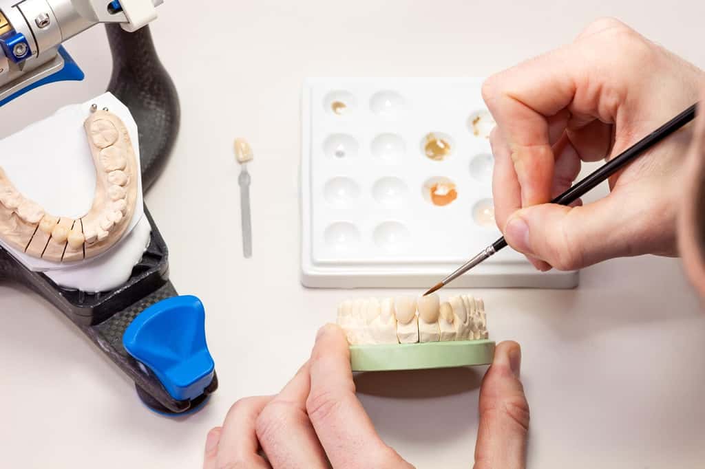 Grâce à son sens de l'observation et sa dextérité, le prothésiste dentaire conçoit des dents plus vraies que nature, qui s'intègrent naturellement dans la bouche du patient. © belahoche, Adobe Stock.