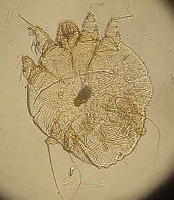 Le sarcopte (<em>Sarcoptes scabiei</em>) est un des nombreux parasites qui pondent sous la peau. © Kalumet, Wikipédia
