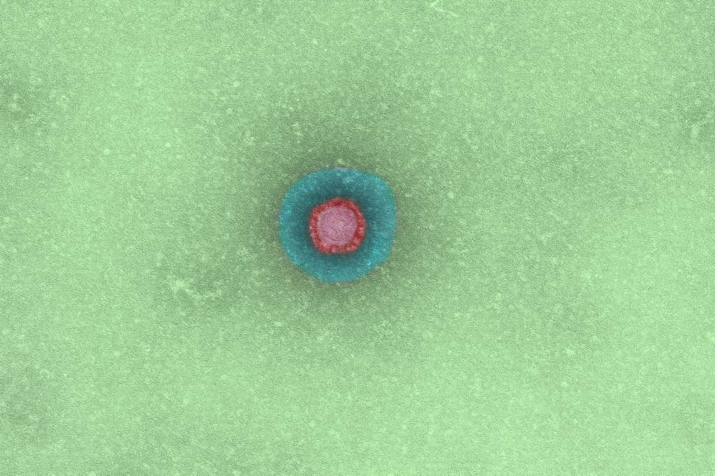 Le coronavirus SARS-CoV. © Institut Pasteur 