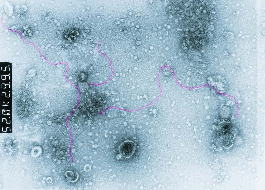 L'agent de la peste <i>Yersinia pestis</i>. © Institut Pasteur